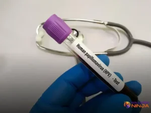 Novo teste molecular para detectar câncer de colo do útero no SUS